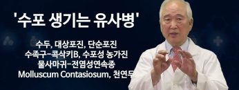 건강하게 삽시다 Monkeypox Health24