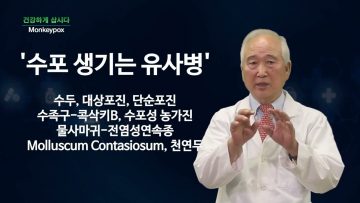 건강하게 삽시다 Monkeypox Health24